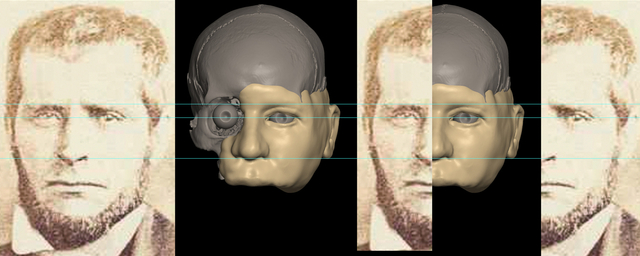 Cranial-Facial Analysis