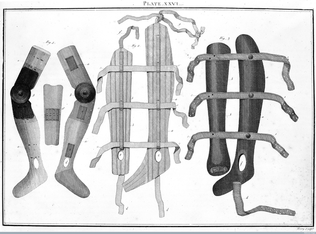 engraving of splints